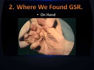 Furthermore, blood or other moisture can defeat the adhesive on the kit collection stubs so that GSR present on the <b>hand</b> may not be effectively transferred to the stubs. . How long does gun residue stay on hands